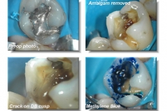 dental 2